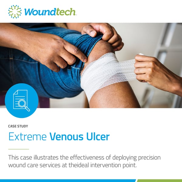 Venous Ulcer graphic